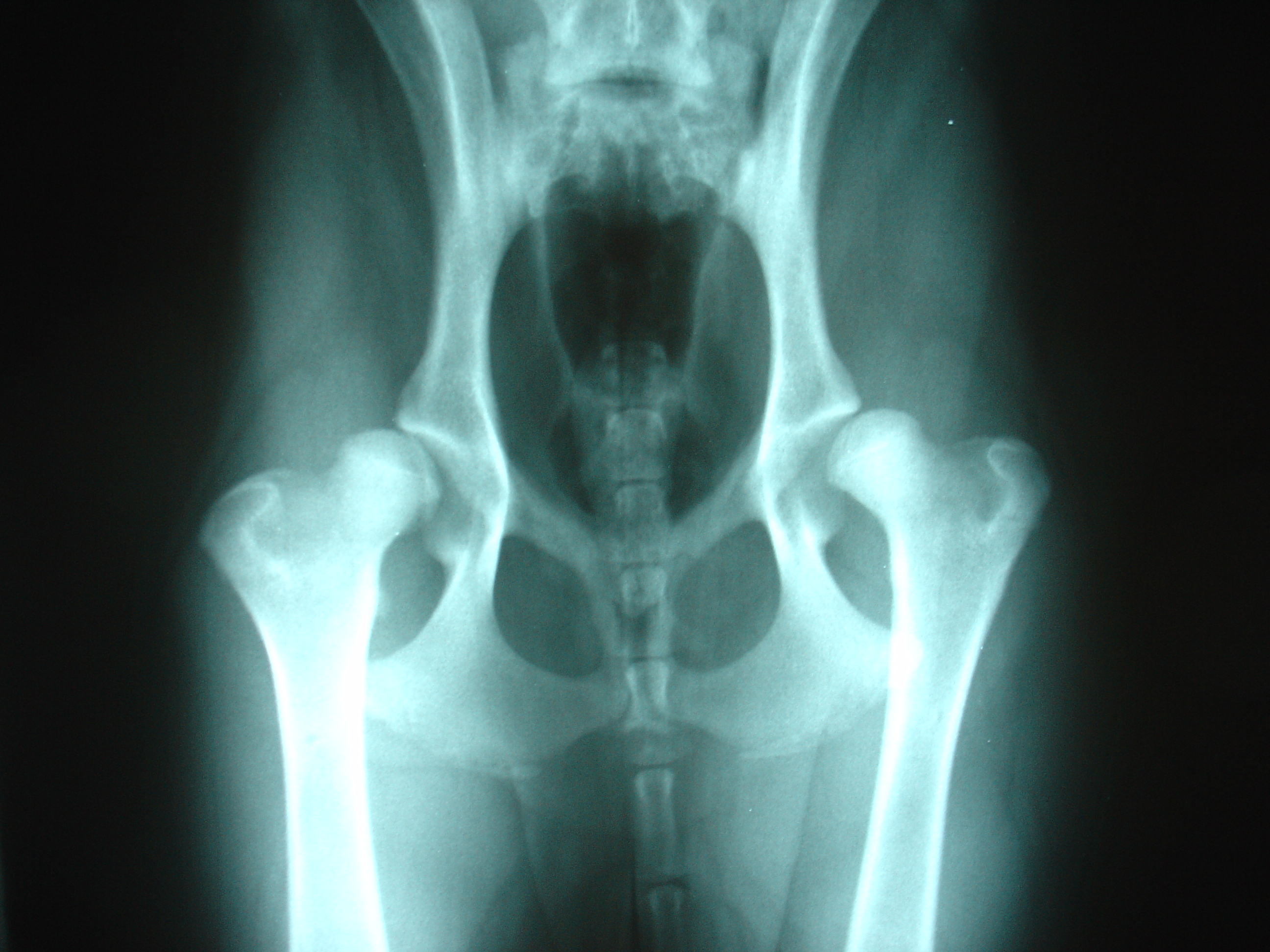 Hip Dysplasia